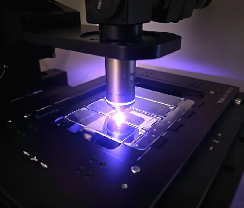 How HyprView Is Using Photonics And AI To Bring Cancer Diagnostics Into the Light